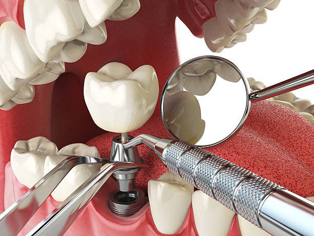 Best Emergency TMJ Treatment in Chilhowie, VA