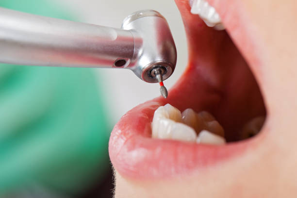 Best After-Hours Dental Trauma Care in Chilhowie, VA